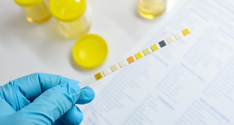 Urine Tests